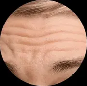 Deep Wrinkles